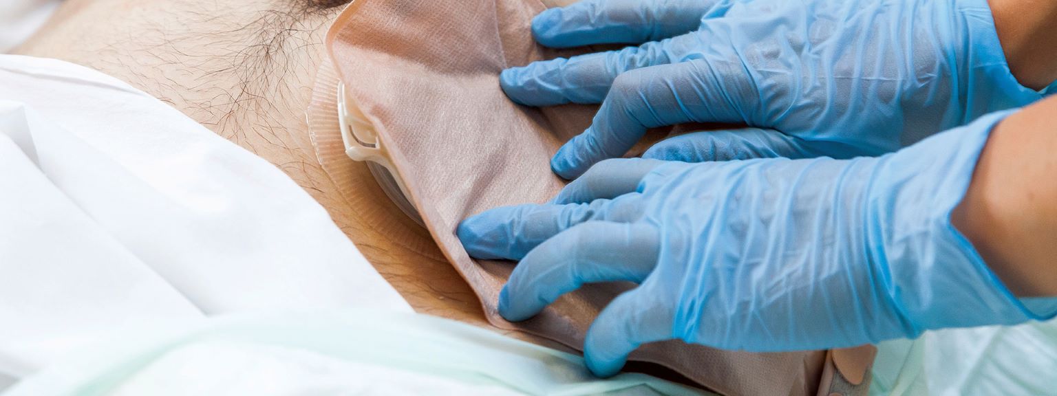 Stoma Care Nursing Services